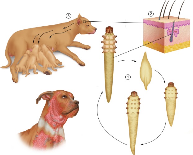 Bệnh ghẻ Demodex là gì?